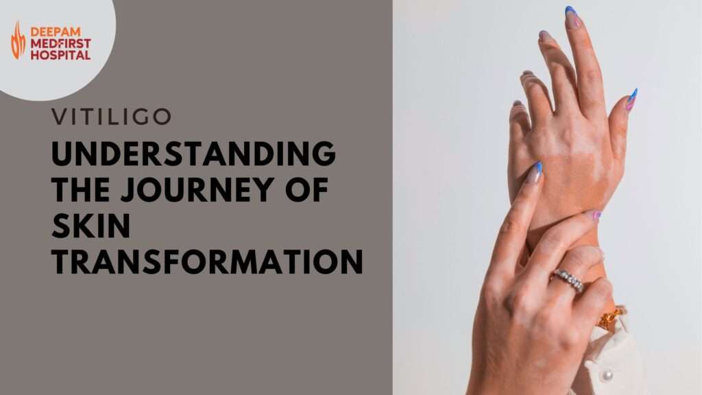 Vitiligo-Deepam MedFirst